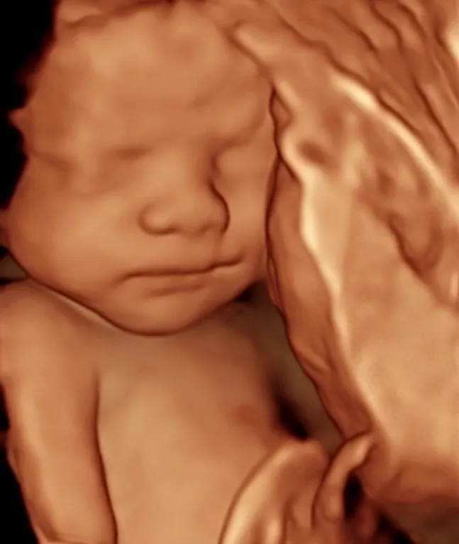 3D ultrasound of beautiful baby