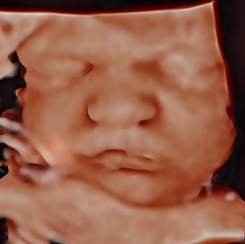 3d ultrasound of baby in hd