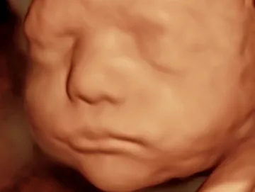 3d ultrasound baby girl