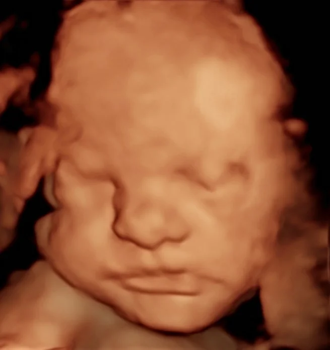 28 weeks 3d ultrasound girl baby face