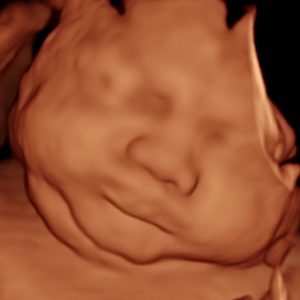 30w4d 4d ultrasound-
