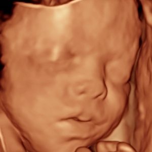 3d ultrasound 29w2d bebe