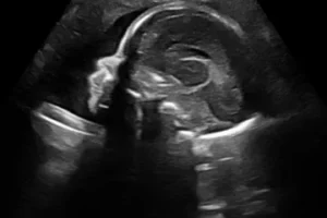 2d ultrasound image