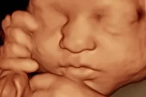 3D image of baby