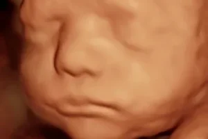 3d ultrasound baby girl