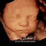 Sweet Moments 3D/4D Ultrasound Studio